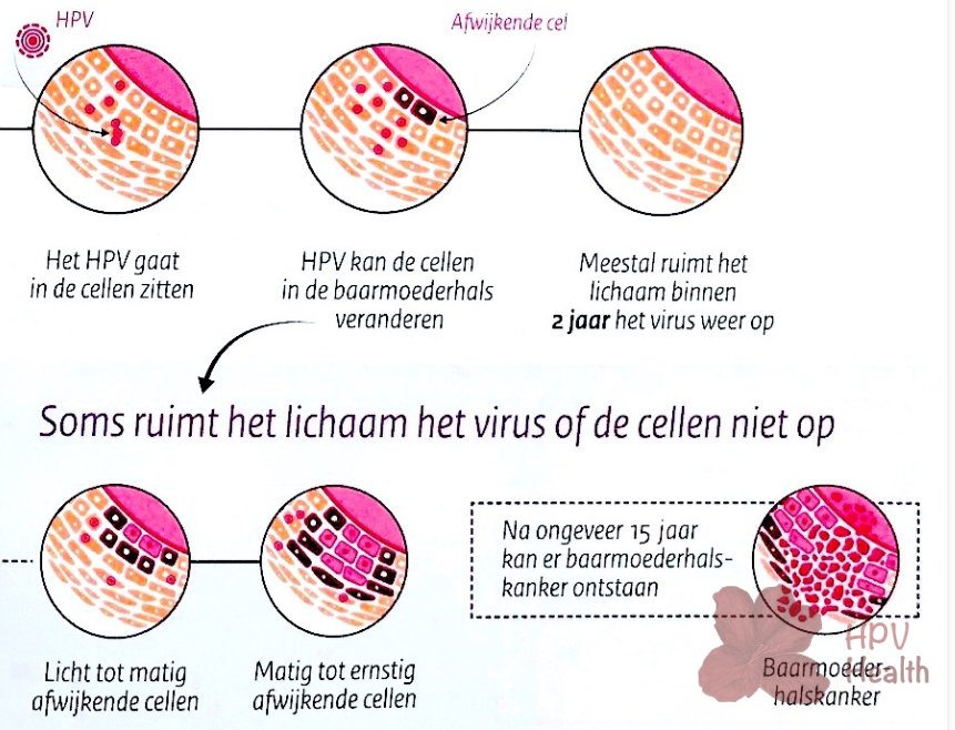 HPV virus wat is het en wat doet het? - HPV Health - Hoe Loop Je Hpv Op