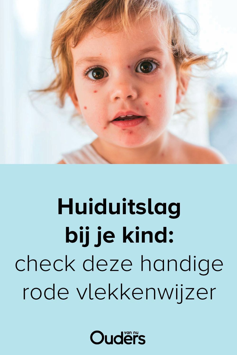 Huiduitslag: handige rode vlekkenwijzer | Peuters, Kind, Baby tips - Huiduitslag Rode Vlekken Met Jeuk