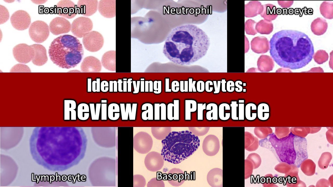 Identifying Leukocytes | Review and Practice - YouTube - Wat Betekent Leukocyten In Urine 3+