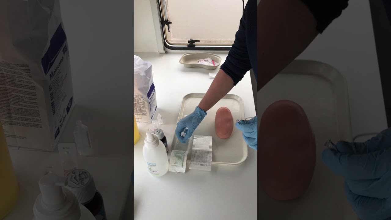 Hoe Lang Mag Een Vleugelnaald Blijven Zitten