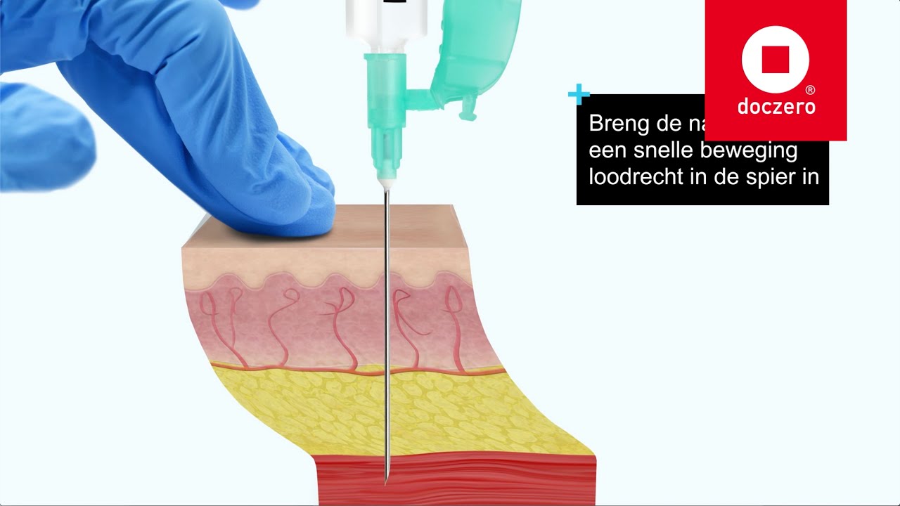 Injecteren intramusculair | Doczero E-learning - YouTube - Hoeveel Insuline Mag Je In 1 Keer Toedienen