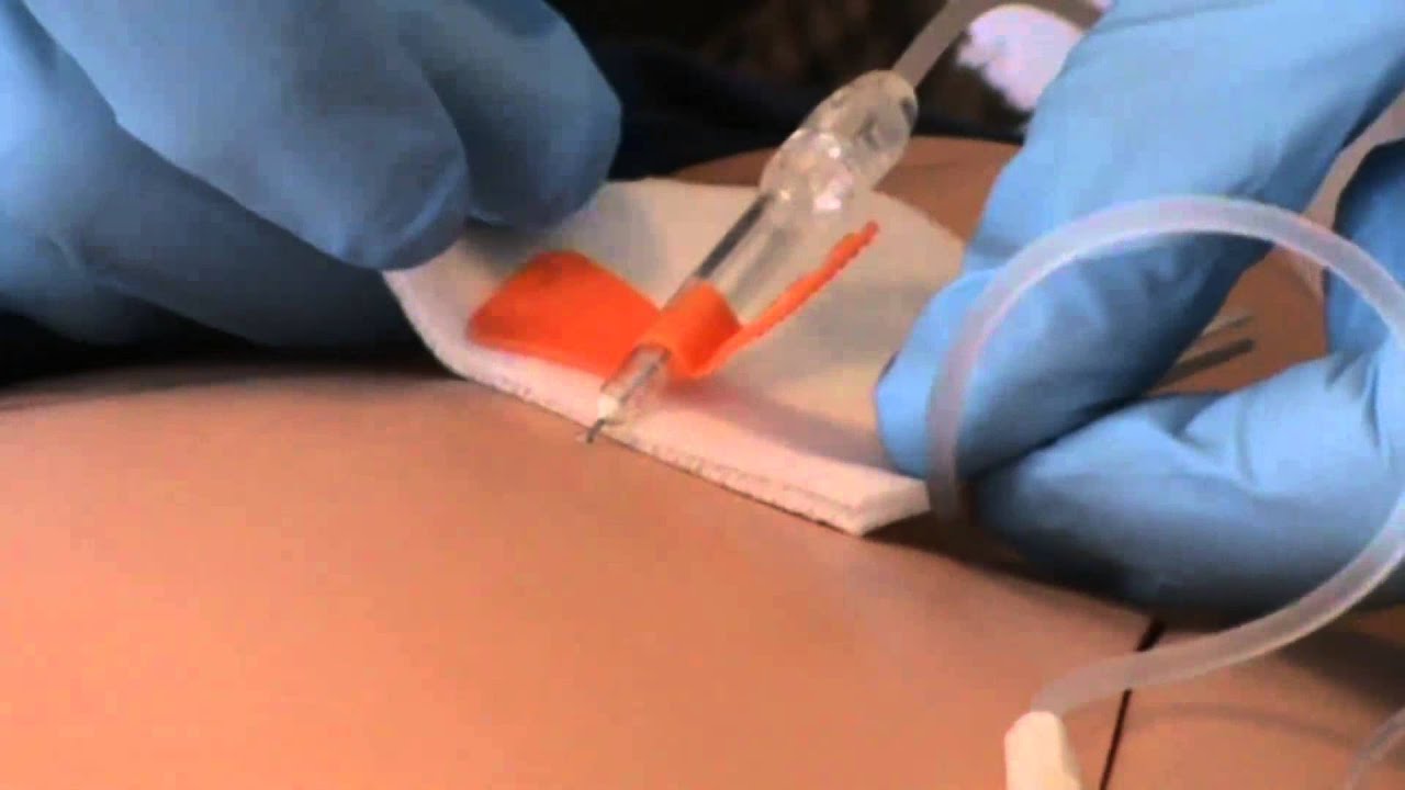 Injecteren Vleugelnaald - YouTube - Morfine Injectie Bij Terminale Patiënten