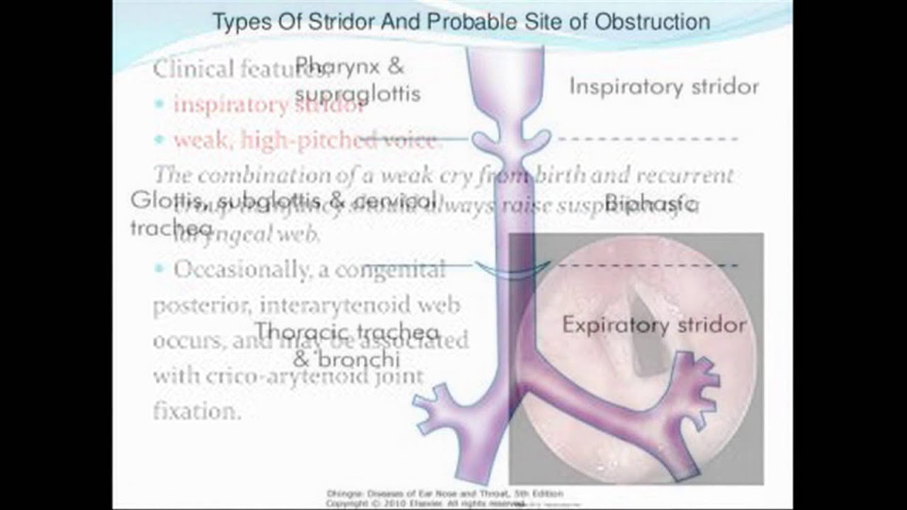 inspiratory Stridor - YouTube - Expiratoire Stridor En Inspiratoire Stridor