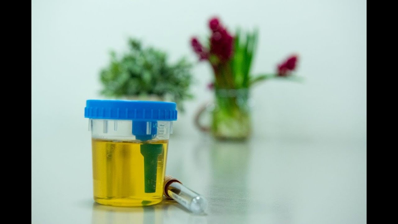 Instructievideo urine verzamelen in urinepotje - YouTube - Hoe Ziet Bloed In Urine Eruit