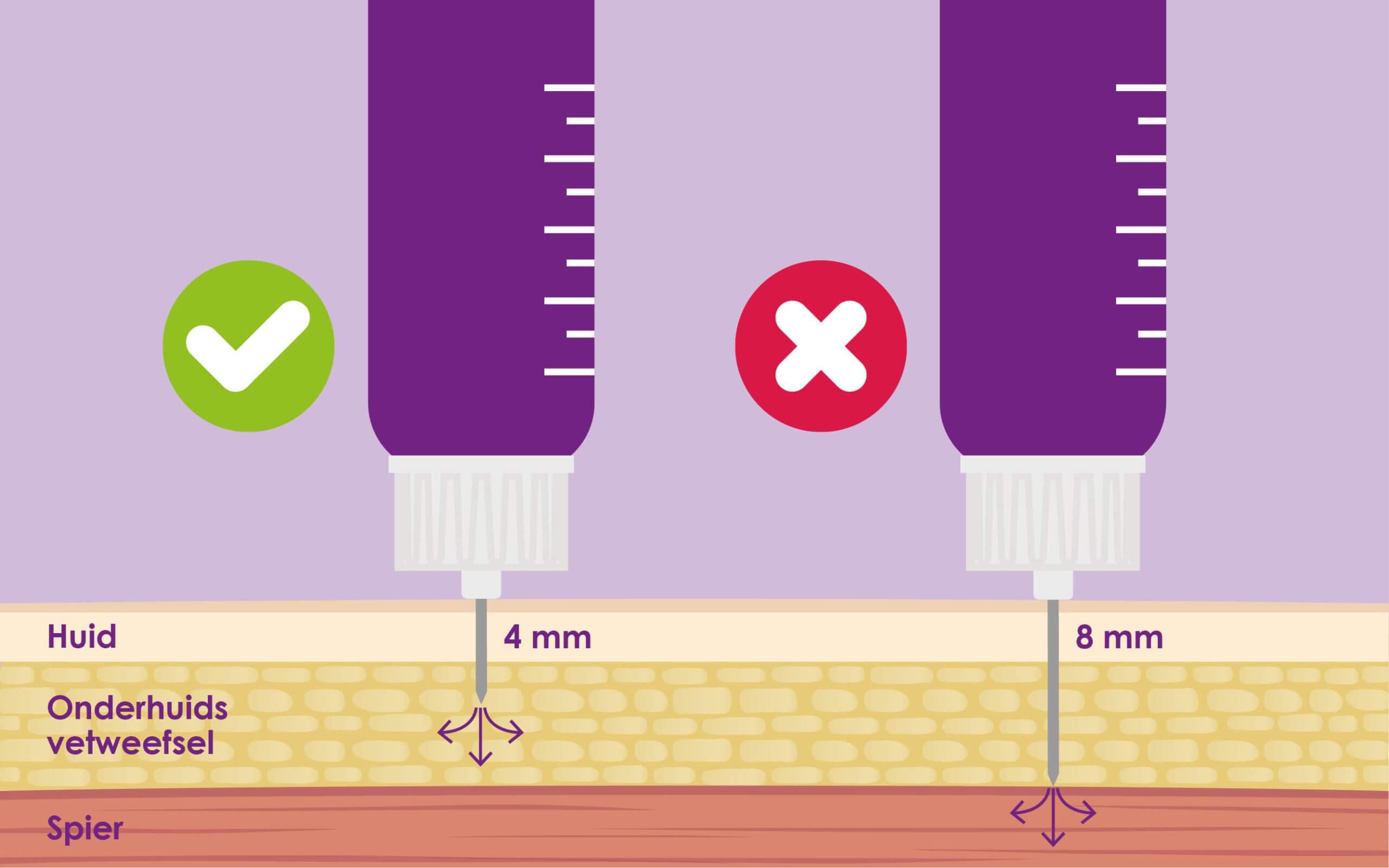 Waarom Mag Je Insuline Niet In Een Spier Injecteren