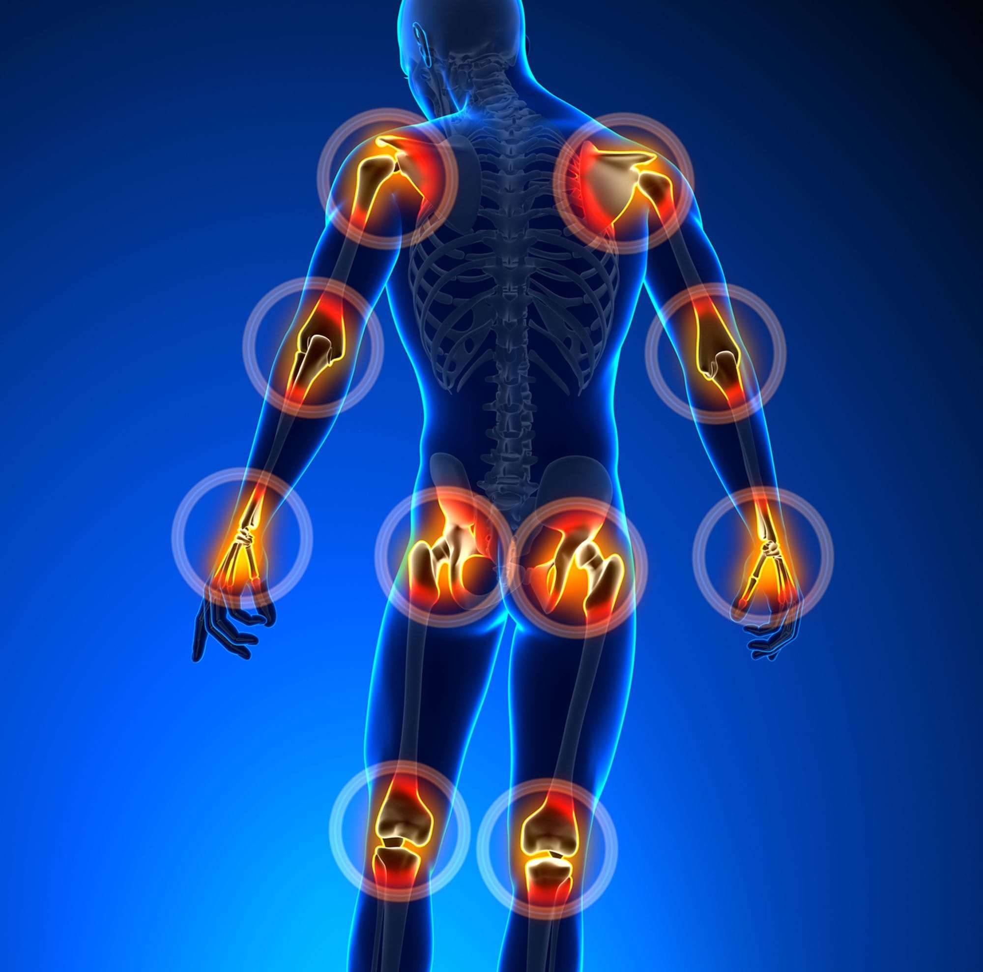 Joint Pain - Novus Spine & Pain Center - Pains Gains And Jobs To Be Done