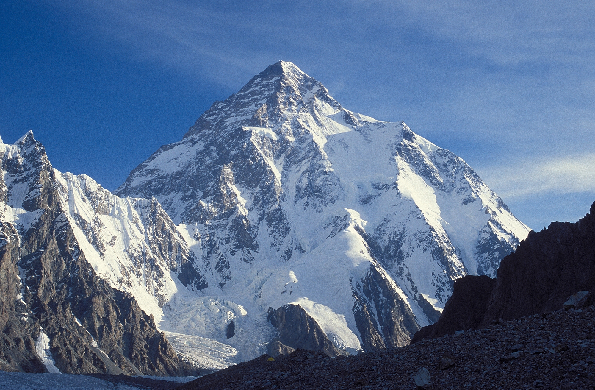 K2, The Second Highest Mountain in The World | Found The World - K2 Squameus Metaplastische Cellen Aanwezig
