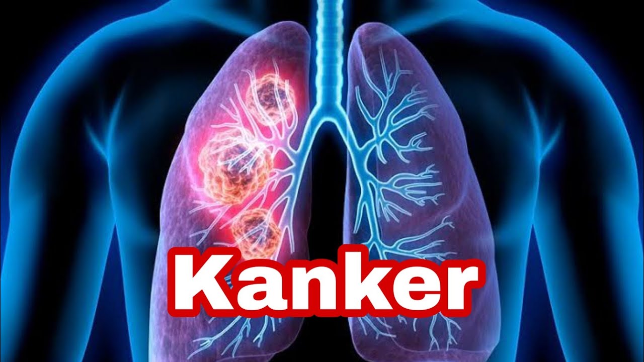 KANKER - YouTube - Wat Doet Kanker Met Je Lichaam