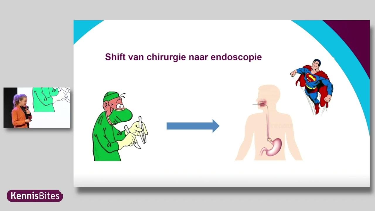 KennisBite: De optimale techniek om vroege kanker in een Barrett - Slijm In Slokdarm En Maag