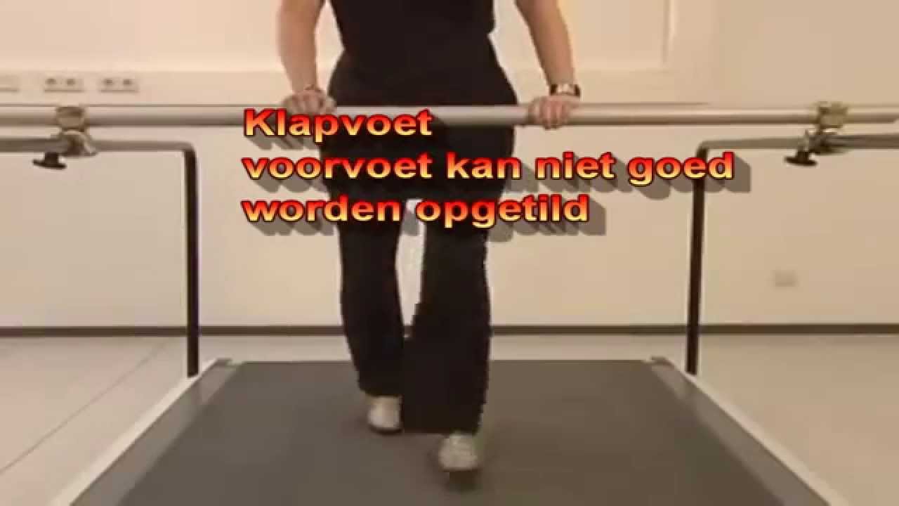 Wat Te Doen Bij Een Klapvoet