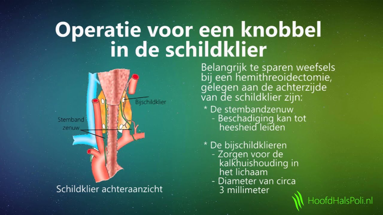Knobbel in de schildklier - YouTube - Linker Teelbal Groter Dan Rechter
