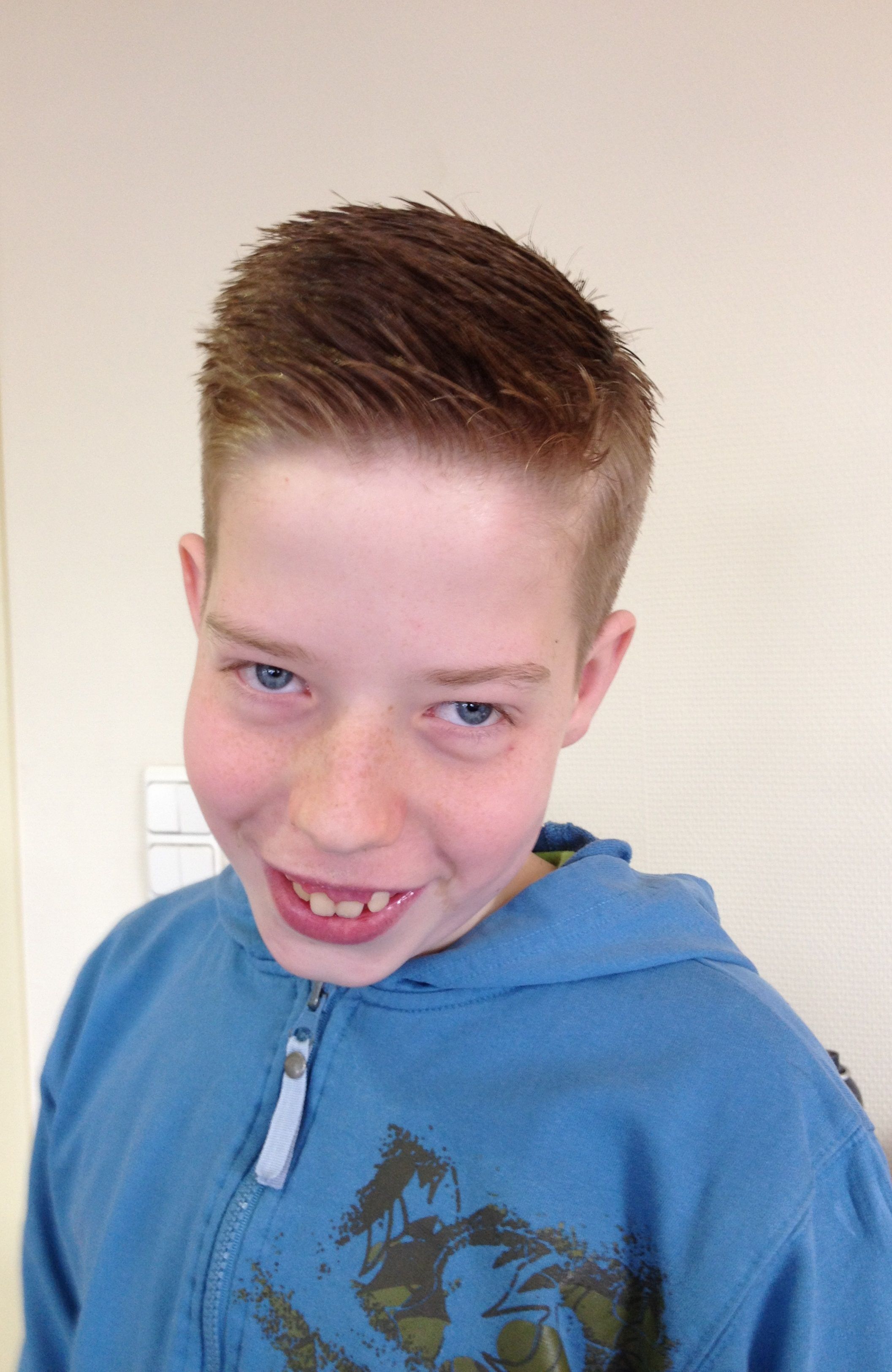 Hoeveel Haren Heeft Een Man Op Zijn Hoofd