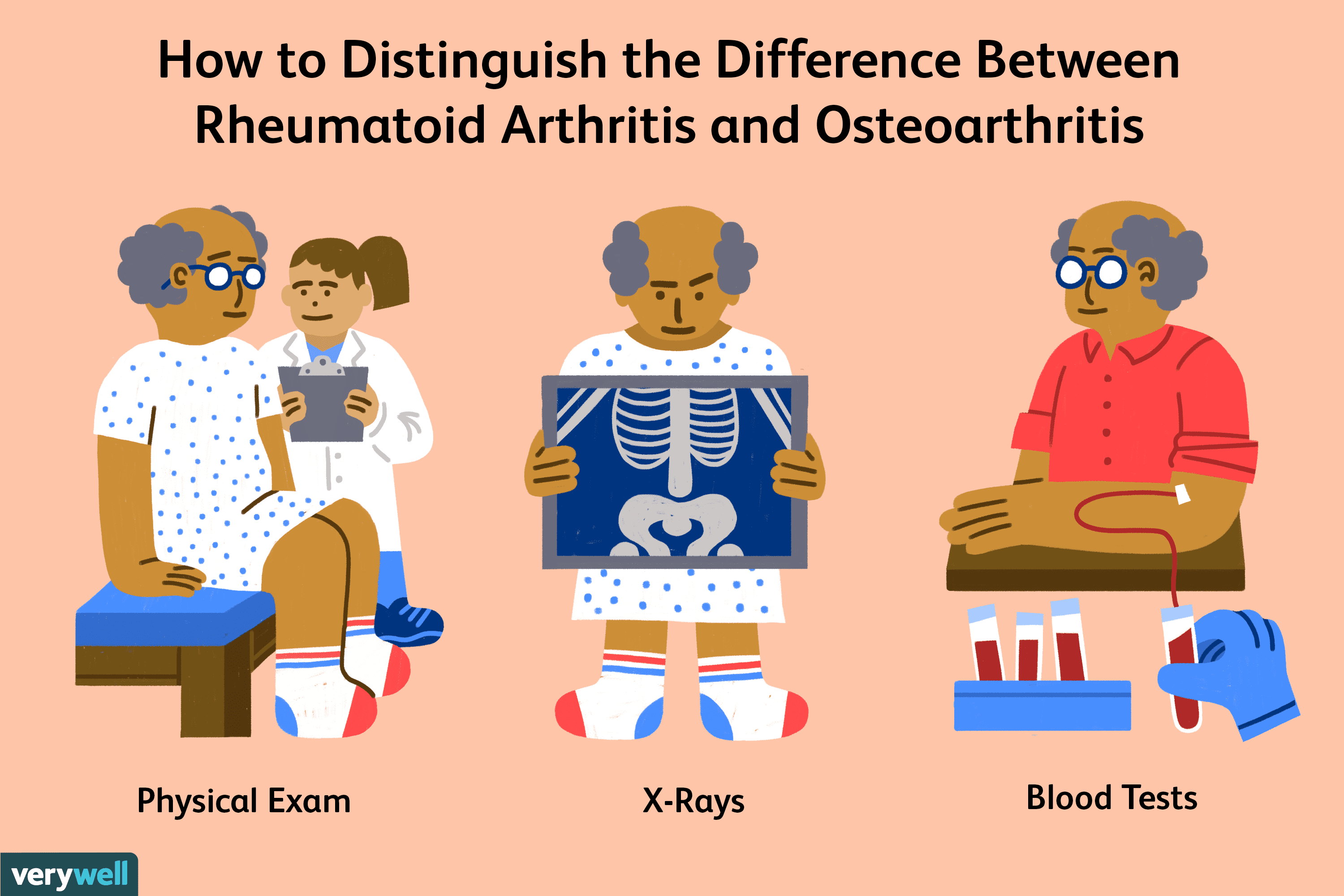 Kun je artrose en reumatoïde artritis samen hebben? - Med NL - Wat Is Het Verschil Tussen Artrose En Artritis
