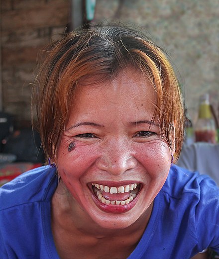 Lachen – Wikipedia - Lachen Op Ongepaste Momenten Autisme