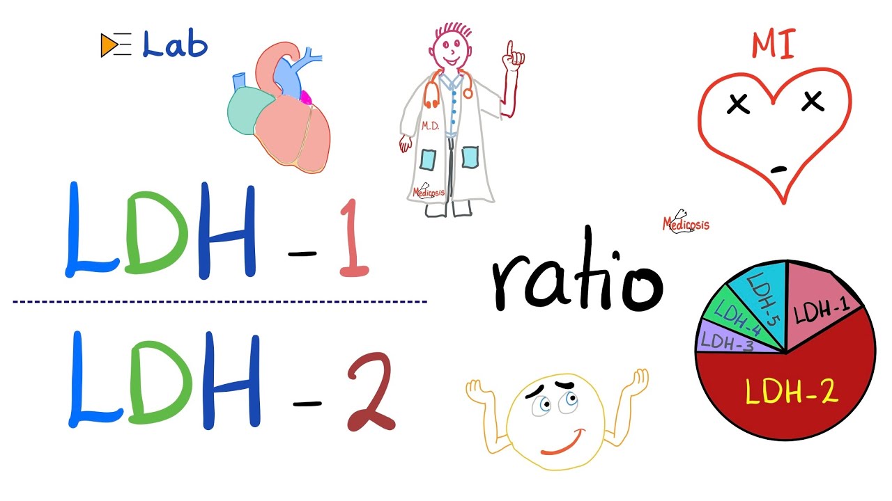 LDH-1 to LDH-2 Ratio (and the flipped LDH) | Lactate Dehydrogenase and - Hoe Hoog Mag De Ldh Waarde Zijn