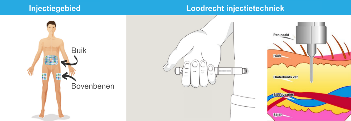 Leer alles over insuline injecteren | Merkala.nl - Waarom Mag Je Insuline Niet In Een Spier Injecteren