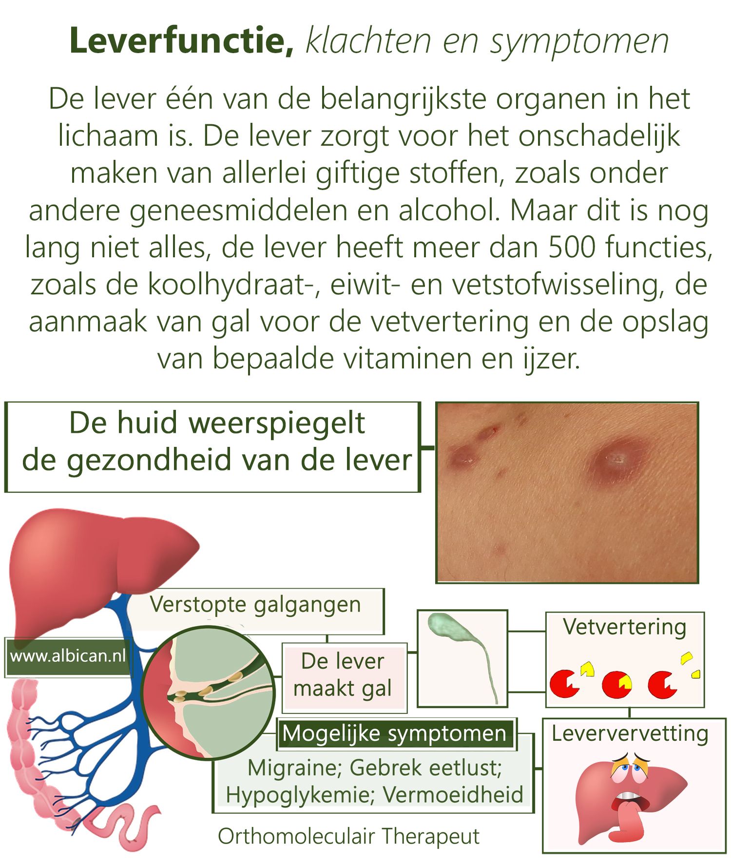 Leverfunctie, klachten en symptomen | Lever reinigen, Lichaam, Alcohol - Alvleesklier Leverontsteking Symptomen Lever Pijn