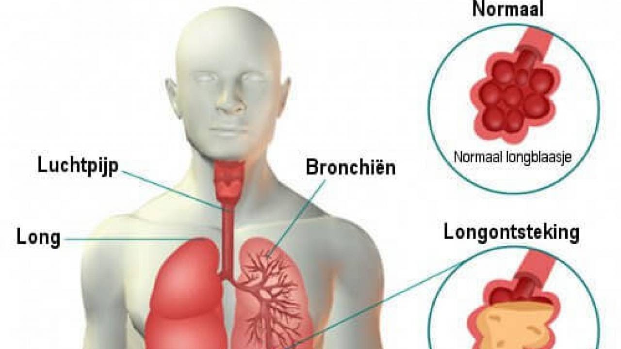 Hoe Ziet Een Kwaadaardige Tumor Eruit