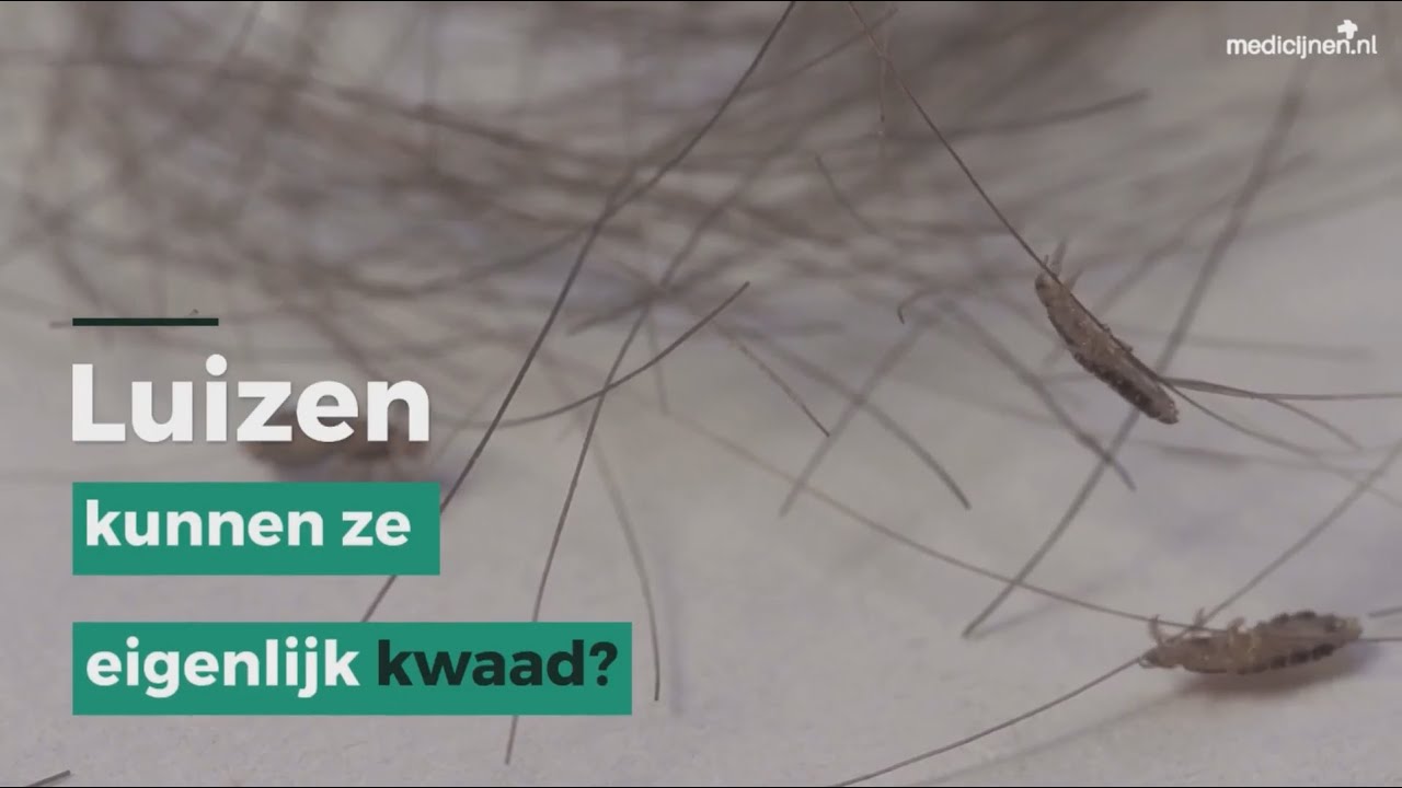 Hoe Zien Luizen Eruit In Je Haar