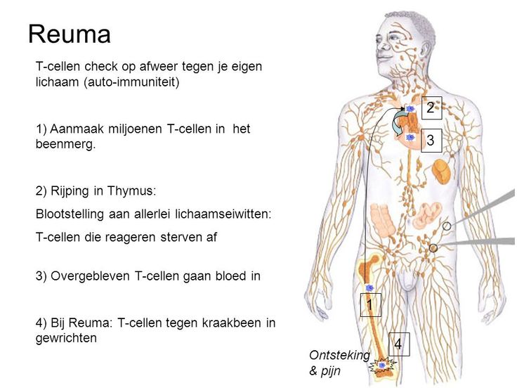 Hoe Groot Is Een Lymfeklier