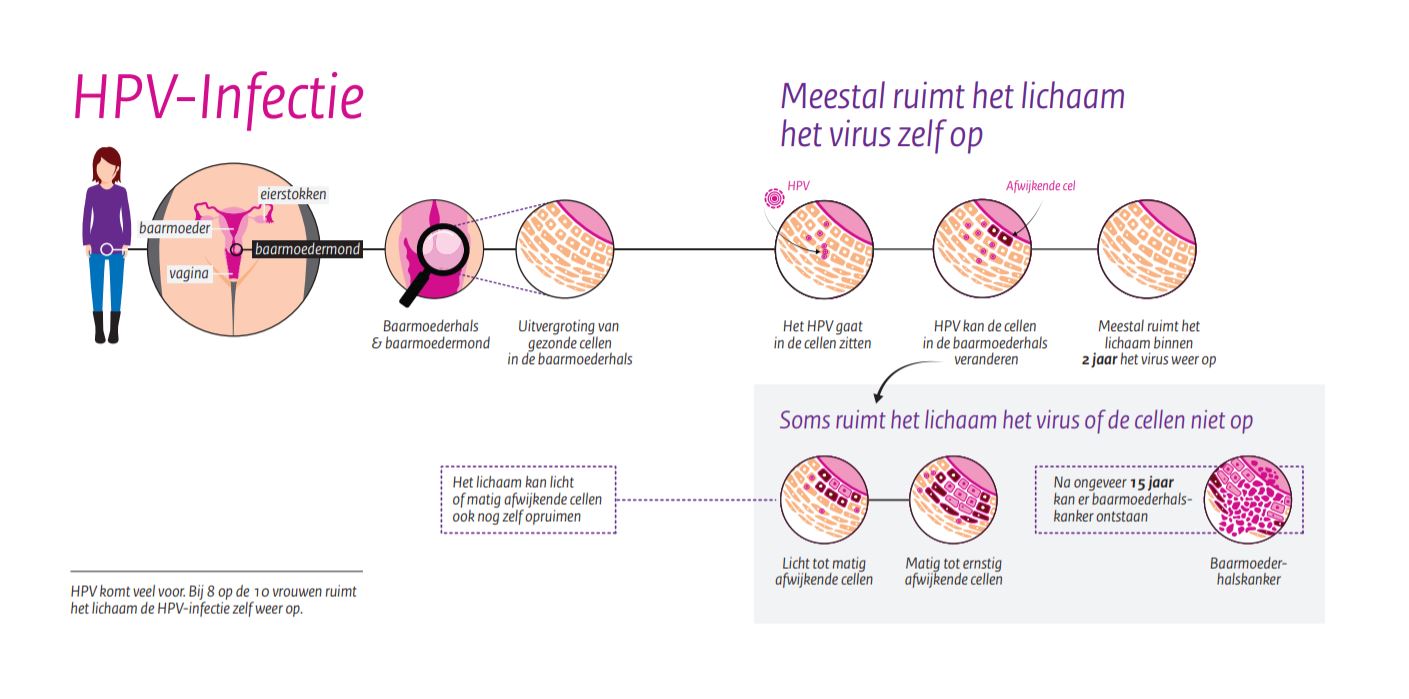 Mijn ervaring - bevolkingsonderzoek baarmoederhalskanker - Elkeblogt - Tot Welke Leeftijd Bevolkingsonderzoek Baarmoederhalskanker
