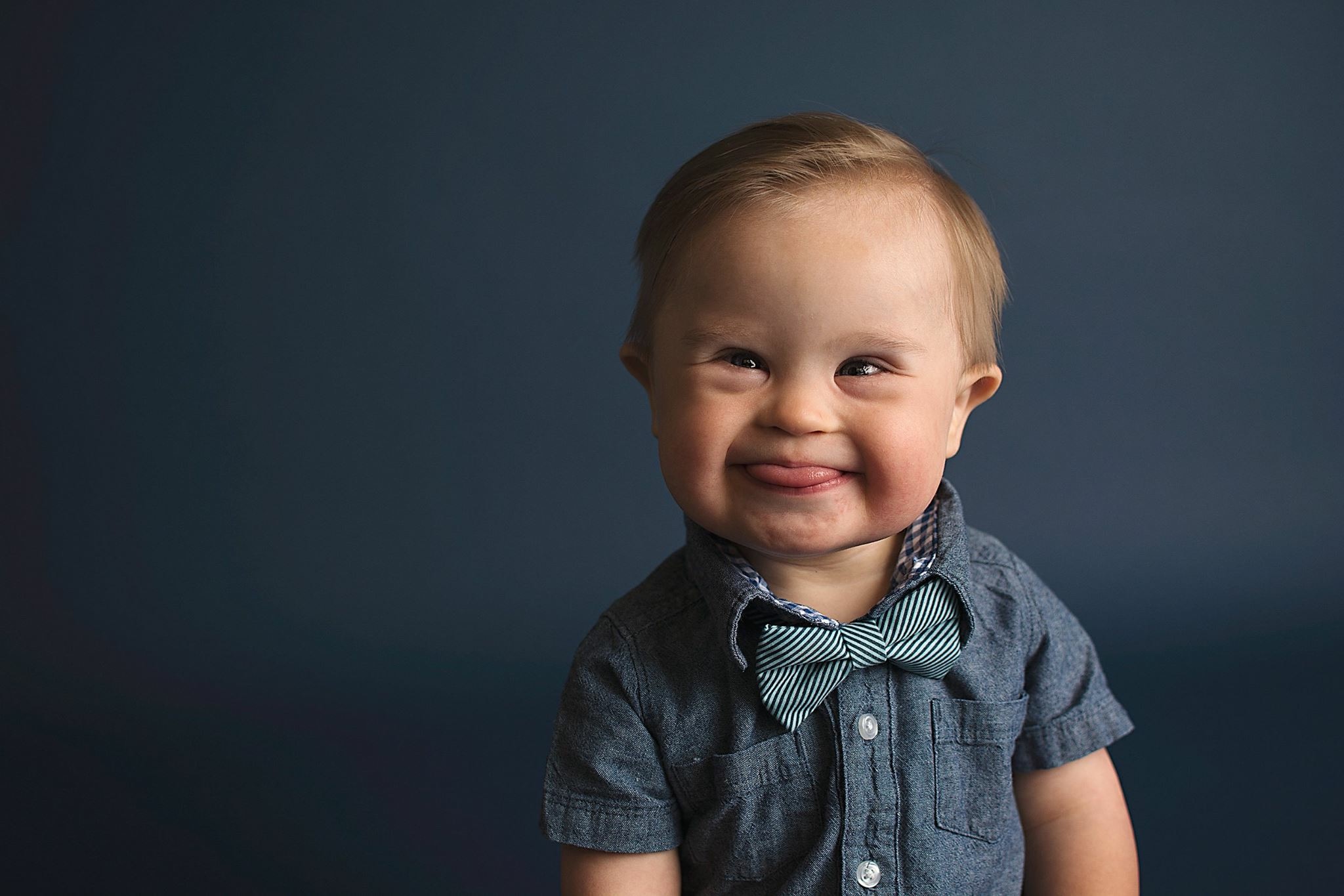 Mom on mission for diverse advertising after son with Down syndrome - Kinderen Met Syndroom Van Down