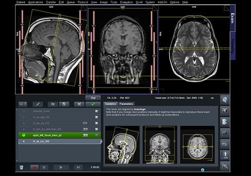 MRI-scan Hoofd & Hersenen | Direct uitslag | Privatescan - Wanneer Contrastvloeistof Bij Mri-scan Hersenen