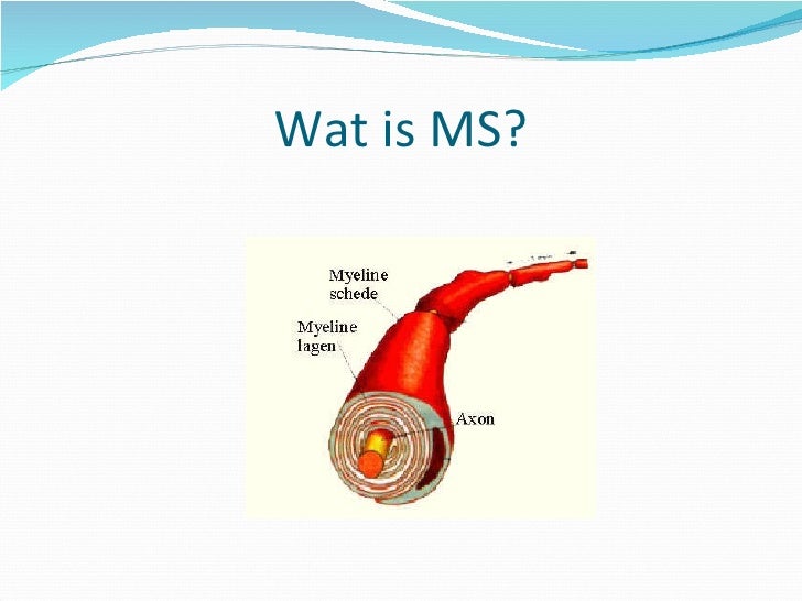 Multiple sclerose - Ms Ziekte Wat Is Dat