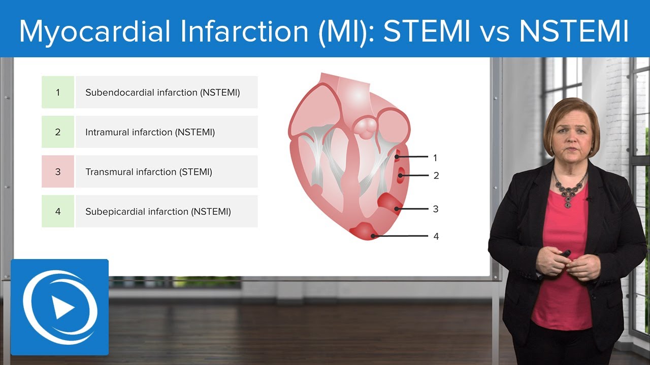 Myocardial Infarction (MI): STEMI vs NSTEMI – Med-Surg Nursing - Verschil Stemi En Non Stemi