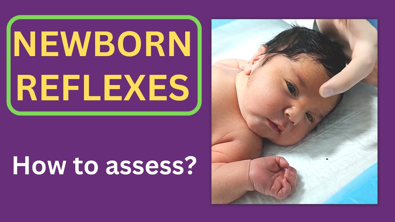 Newborn reflexes | 8 vital reflexes of infants - YouTube - Welke Reflexen Heeft Een Baby In Het Begin