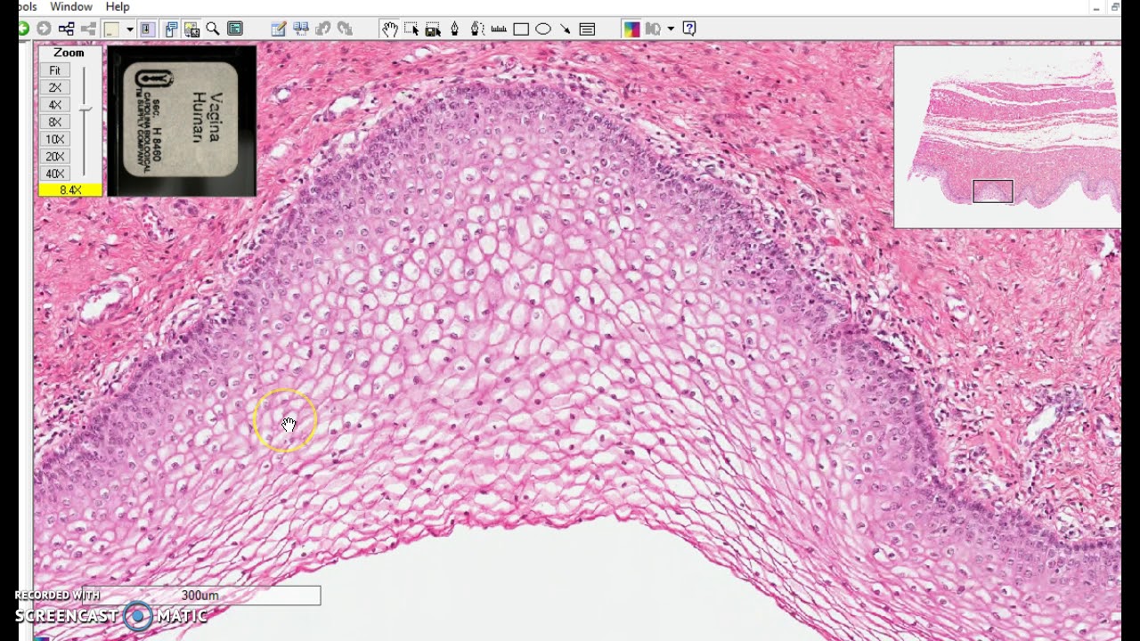 non-keratinized stratified squamous epithelium - YouTube - Endocervicale Cylindrische- En Squameus Metaplastische Cellen