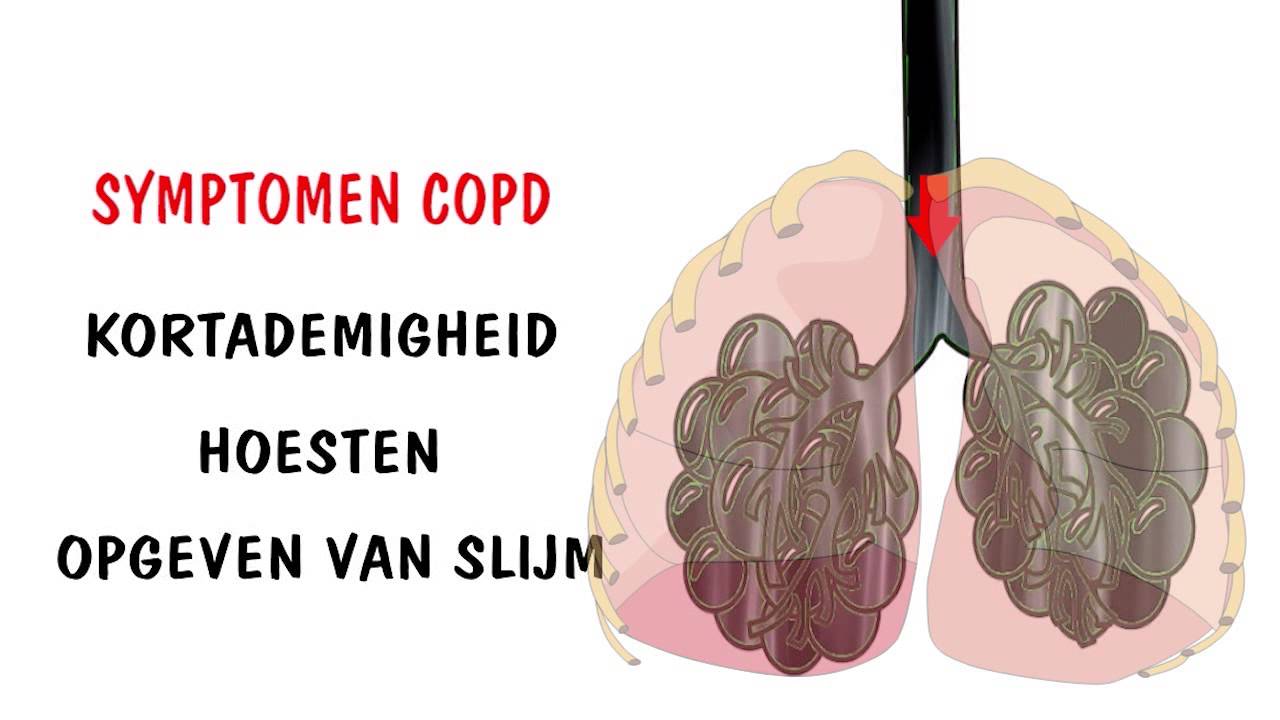 Onderdeel 1 Wat is COPD - YouTube - Hoeveel Liter Zuurstof Bij Copd