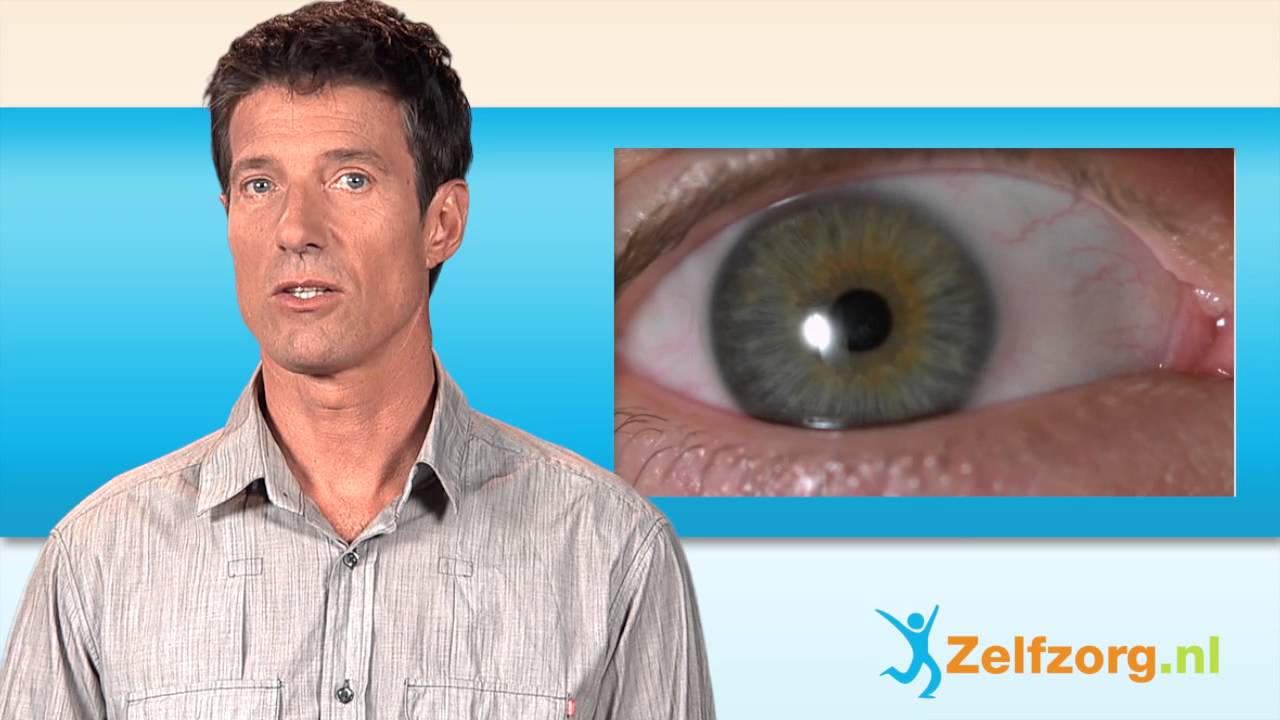 Blinde Vlek In Het Oog