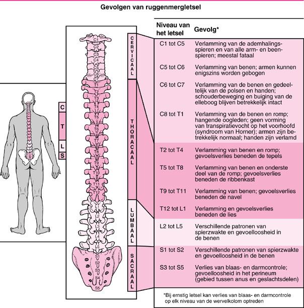 Mechanische En Neurogene Lumbale Pijn