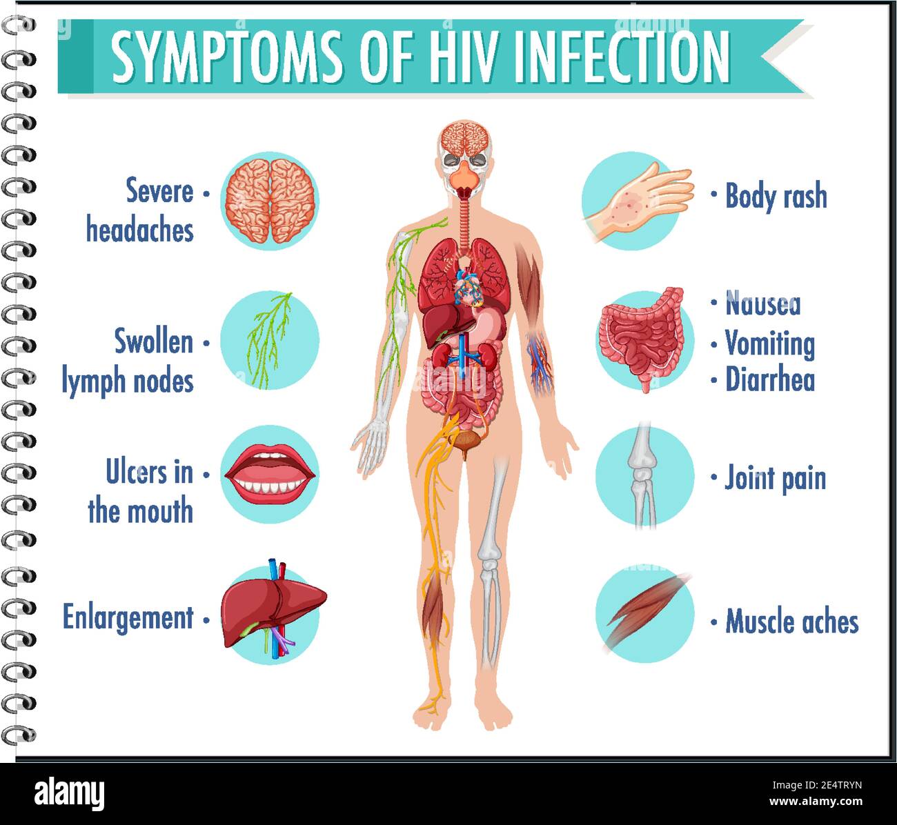 Oral Manifestations Of Hiv Disease In Milton Keynes - Wat Doet Aids Met Je Lichaam
