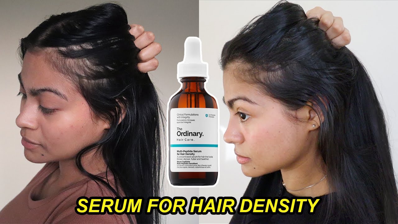 Ordinary Serum - Welke Ordinary Serum Past Bij Mij