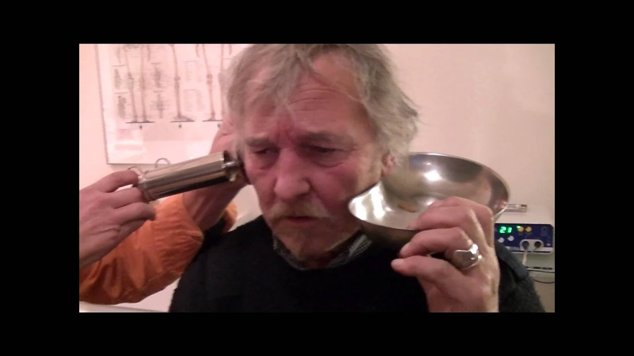 Oren uitspuiten doe je zo - YouTube - Oorsmeerprop Hoe Ziet Een Oorprop Eruit