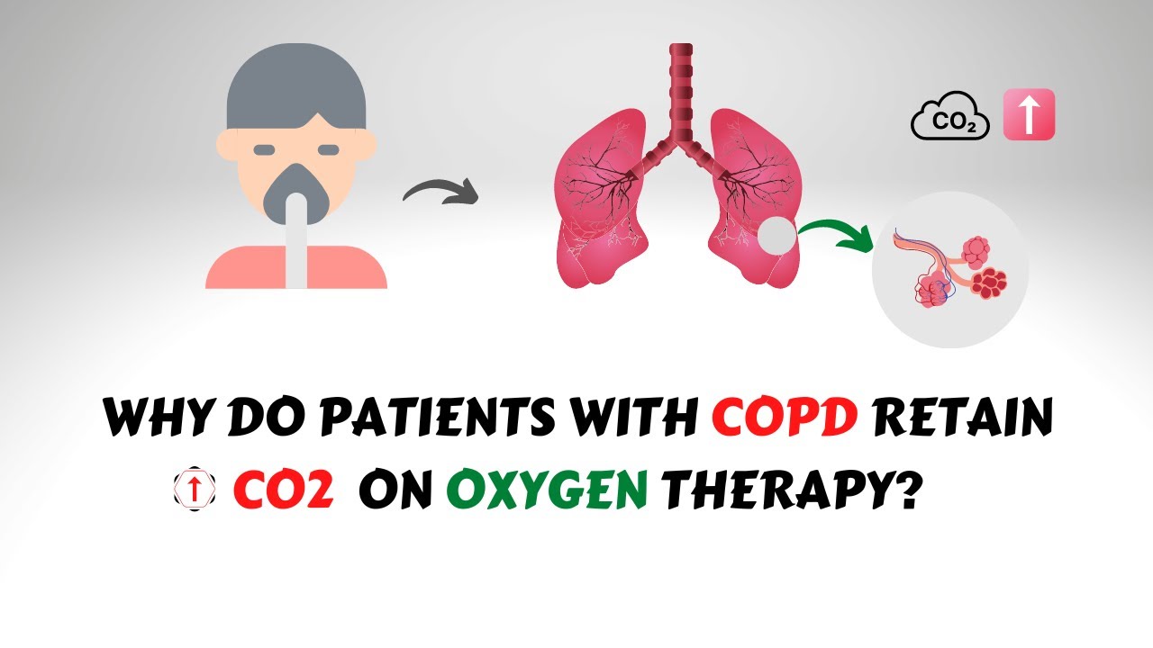 Oxygen Induced CO2 Narcosis in COPD Patients - YouTube - Teveel Co2 In Het Bloed