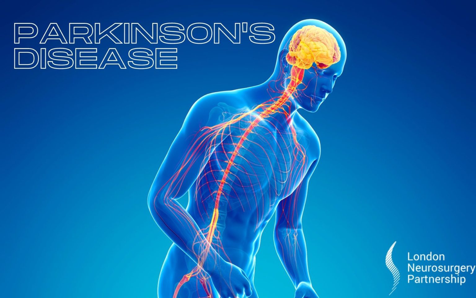 Parkinson's Disease - London Neurosurgery Partnership - Wat Is Erger Parkinson Of Parkinsonisme