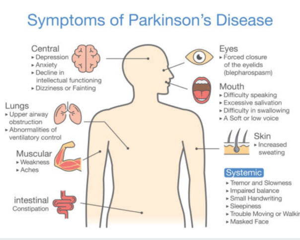 Parkinson's Disease | Neuphysio - Wat Zijn De Symptomen Van Parkinson