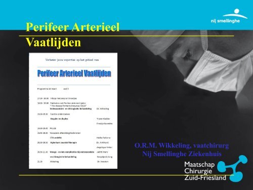 Perifeer Arterieel Vaatlijden - Vaatchirurg - Verschil Perifeer En Arterieel Vaatlijden