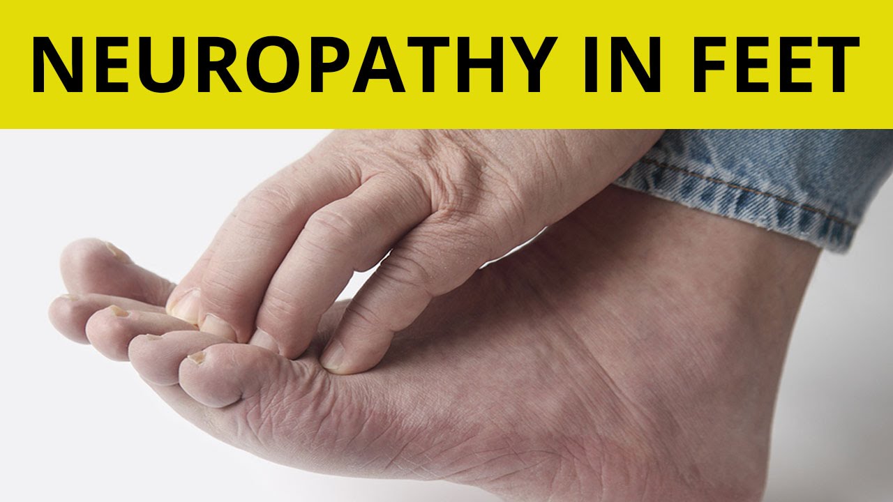 Peripheral Neuropathy Treatment | 9 Tips On How to Handle Neuropathy in - Wat Is Neuropathie In De Benen