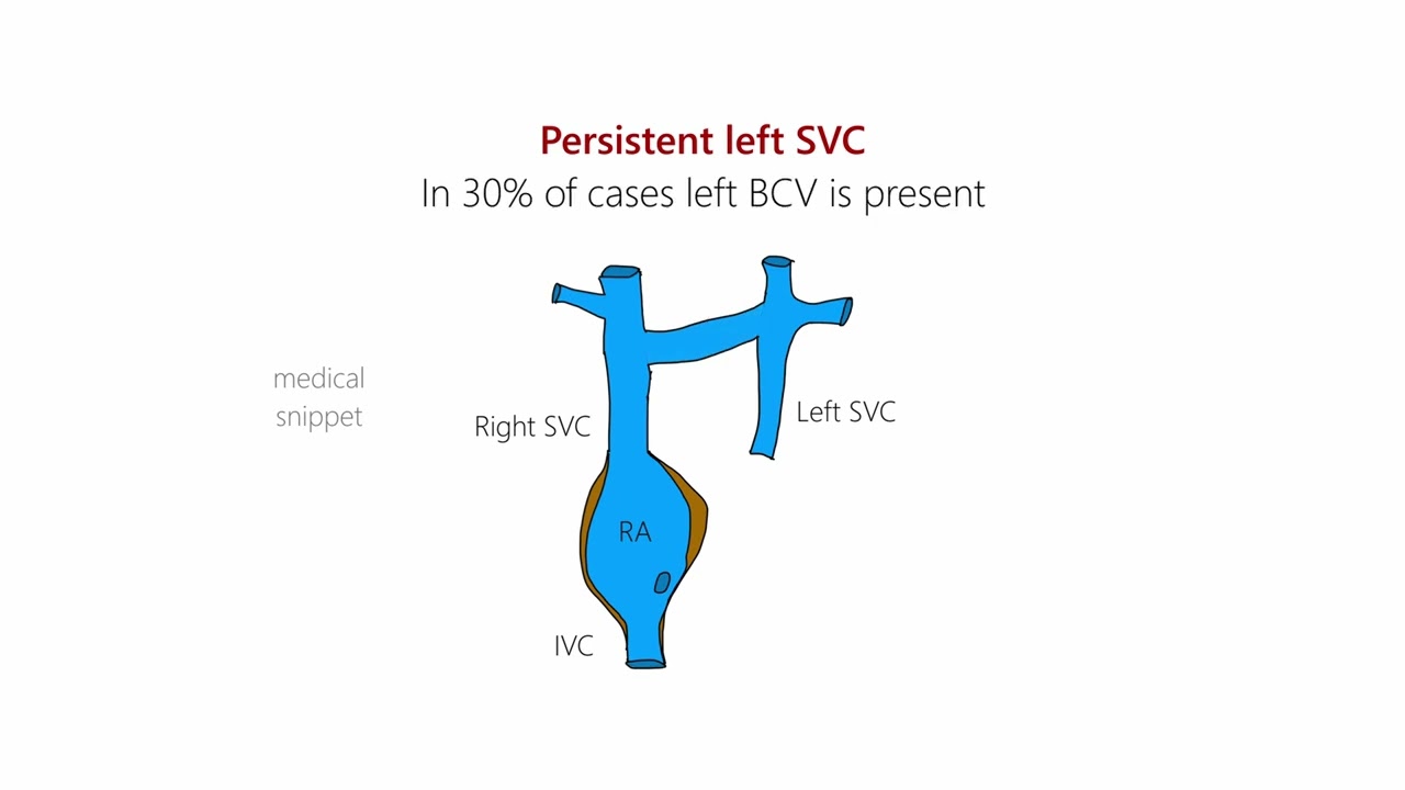 Vena Cava Superior Syndroom Symptomen