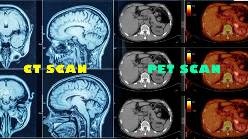 Verschil Mri En Ct Scan En Pet Scan