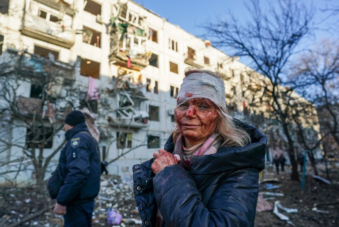 Photos: Aftermath of Russian air strikes in Ukraine’s Kharkiv | Russia - Hoe Lang Is De Oorlog In Oekraine Al Bezig