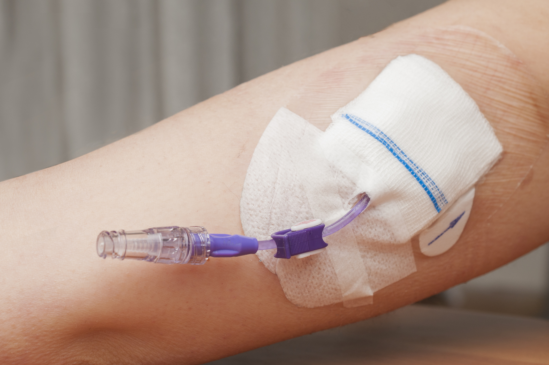 Picc Catheter - Verschil Picc Lijn En Centraal Veneuze Katheter