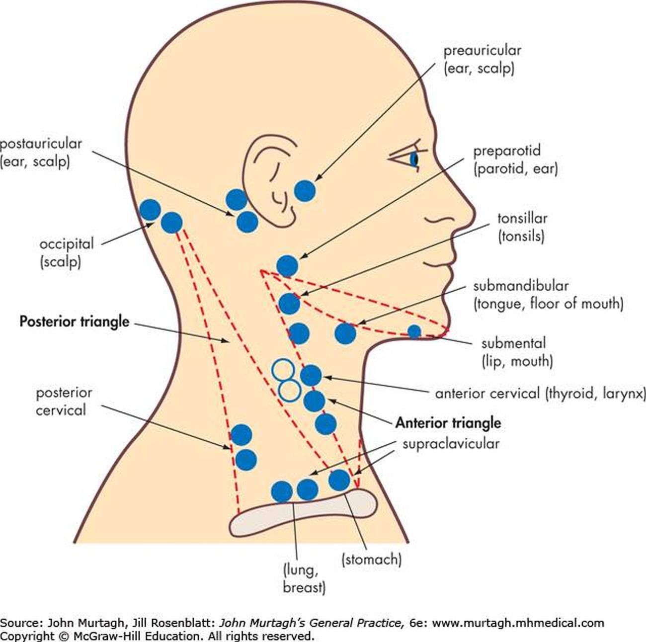 Pictures Of Anterior Cervical Lymph Nodes | Lymph nodes, Cervical - Waar Zitten Je Lymfeklieren Hals