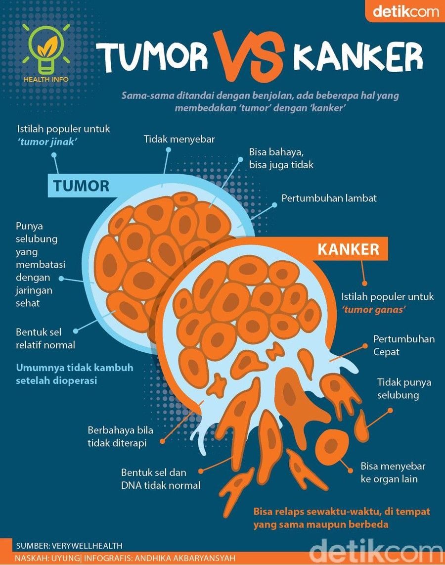 Is Een Tumor Hard Of Zacht