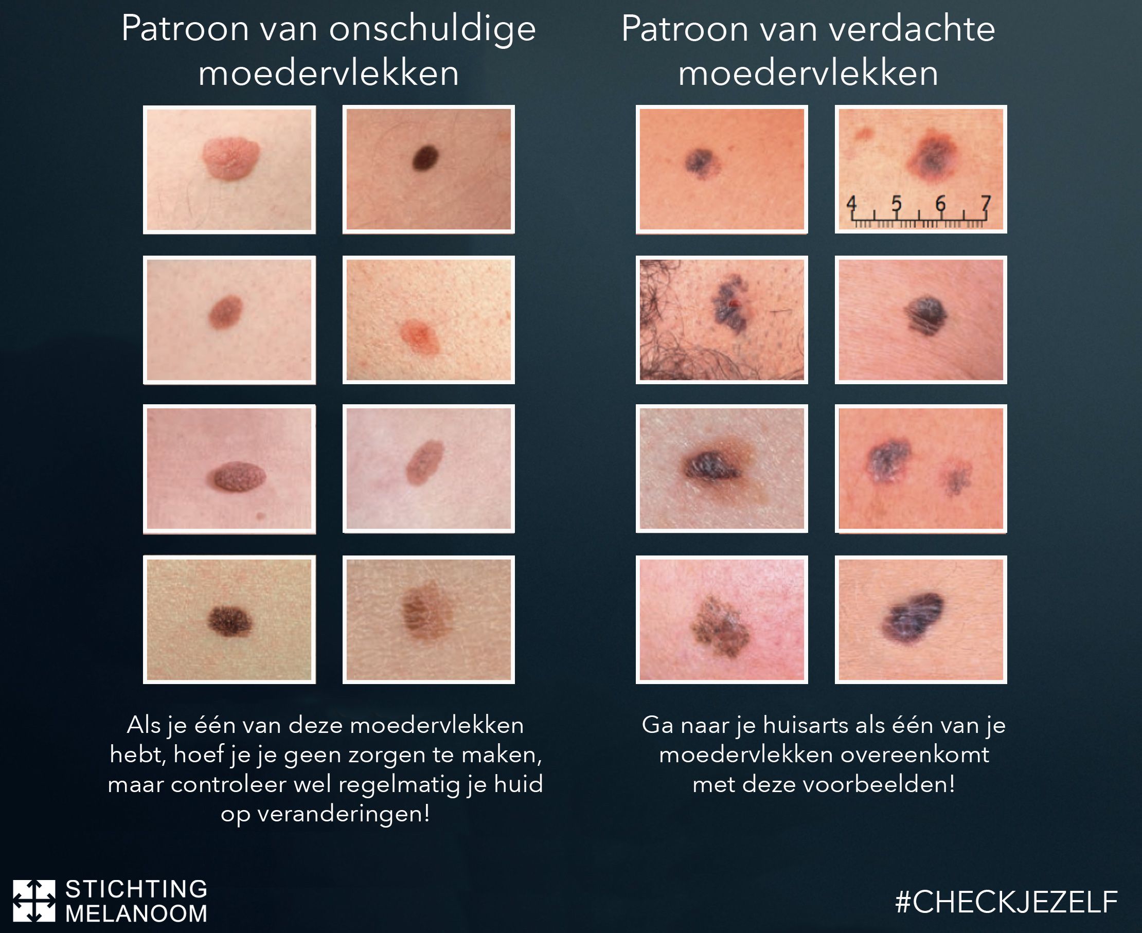 Pin op Handig! - Traditionele Rode Stip Op Het Voorhoofd Van Een Hindoe Vrouw
