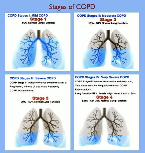 Laatste Fase Copd Zuurstoftoediening Flow